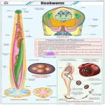 Hookworm Classification Educational Chart